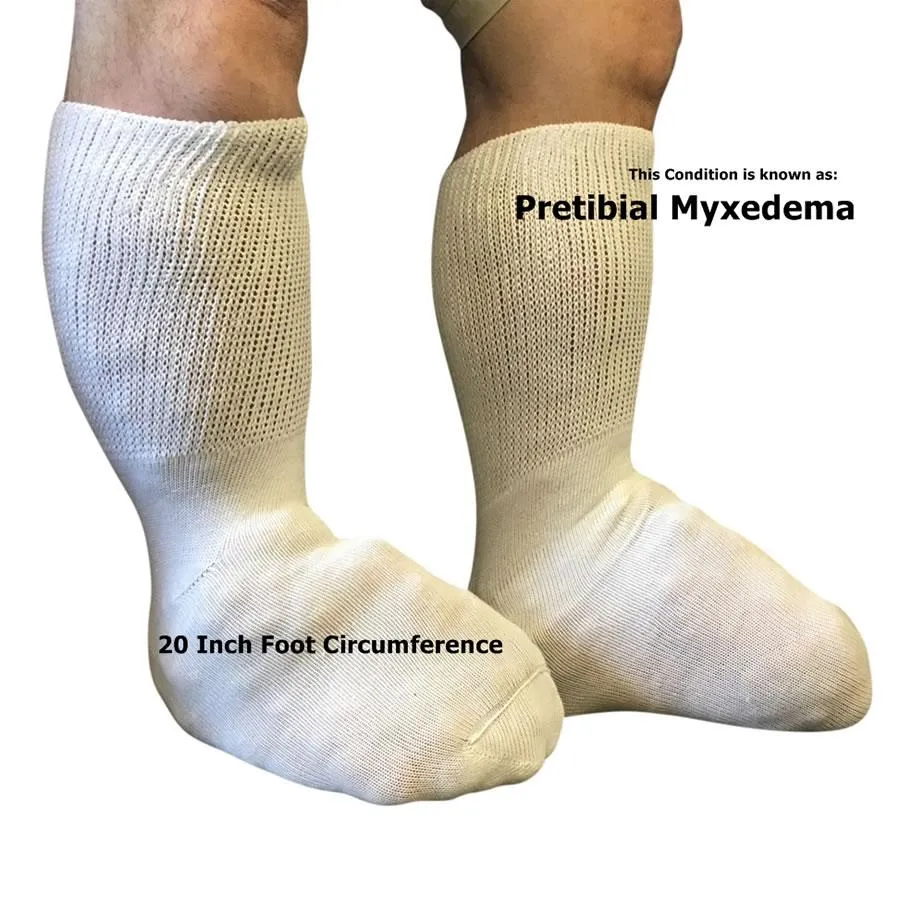 Extra Wide Bariatric Sock  (2PK)